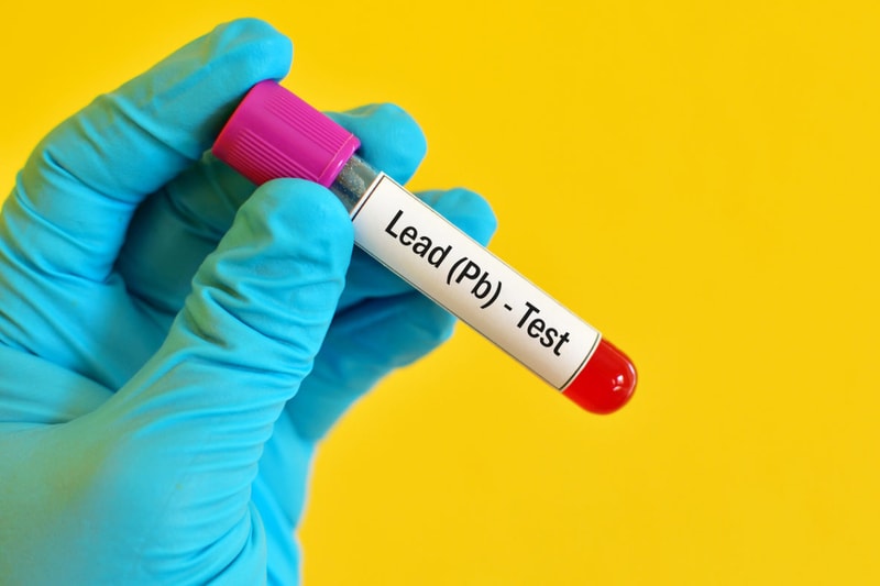 Man holding a lead blood test